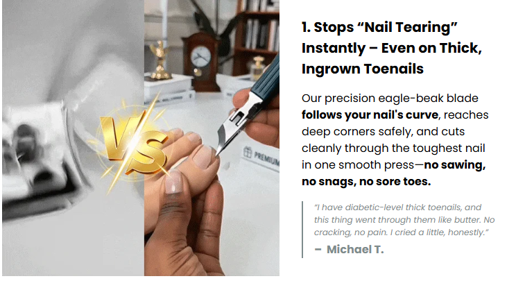 💥Why 60,000+ People Are Throwing Away Their Old Nail Clippers for This Eagle Beak Design 🔥